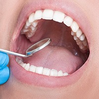 Metal Free Dental Restorations in Melrose, MA