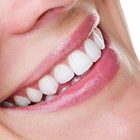 Dental Bonding from Pan Dental Care in Melrose, MA